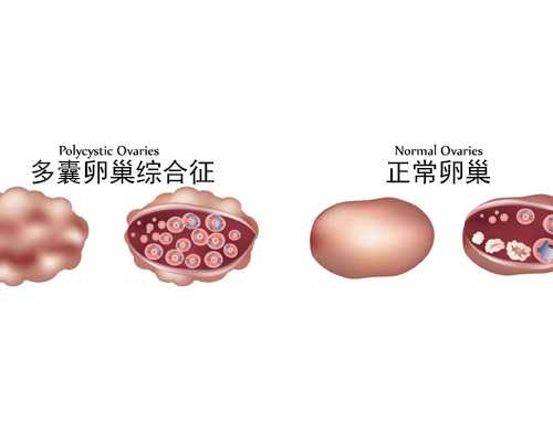 代怀妈妈咨询,天津供卵医院-正规助孕网