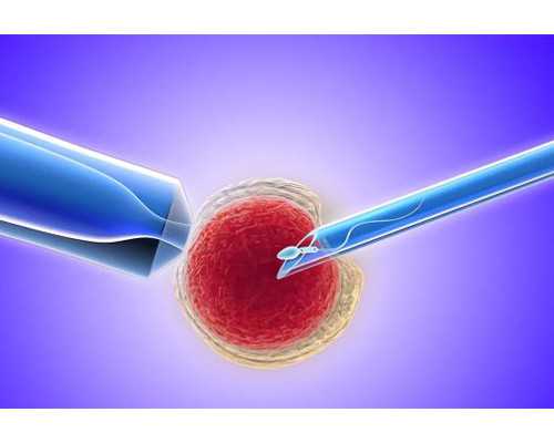 靠谱代怀,深圳助孕试管婴儿助孕步骤是什么样的