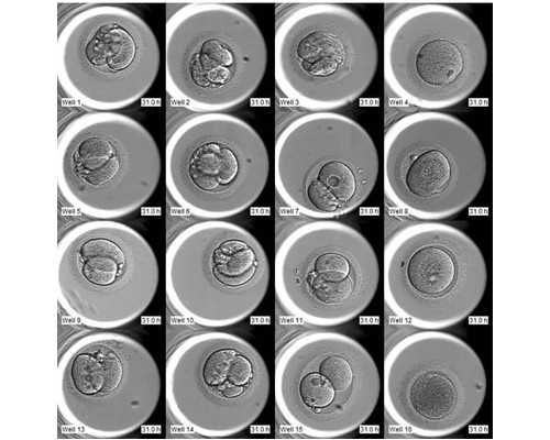 同性代生孩子,鄂州哪里可以做第三代助孕试管婴儿？