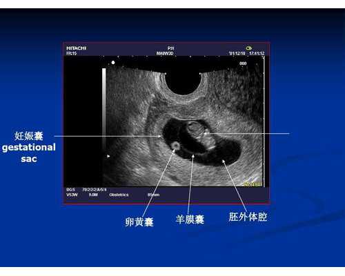 广州试管代孕网,【广州供卵试管助孕公司】我是一枚90后宝妈，俺是大徽州人是