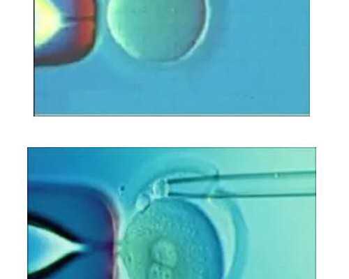 供卵哪里可靠,北京合法助孕试管中心