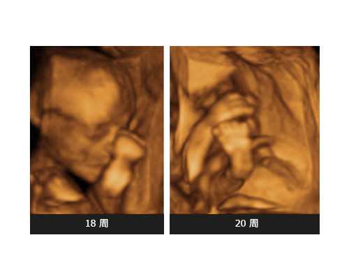 代生小孩机构,试管婴儿助孕食谱 这些食谱赶紧Get起来