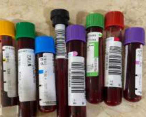 广州试管代孕医院大全,做试管婴儿饮食不能吃什么_输卵管造影检查通畅 为什么